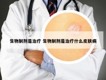 生物制剂是治疗 生物制剂是治疗什么皮肤病