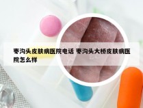 枣沟头皮肤病医院电话 枣沟头大桥皮肤病医院怎么样