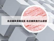 白点癫风发展征兆 白点癫风有什么症状