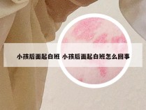 小孩后面起白班 小孩后面起白班怎么回事