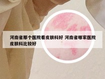 河南省那个医院看皮肤科好 河南省哪家医院皮肤科比较好