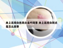 身上出现白色斑点是咋回事 身上出现白斑点是怎么回事