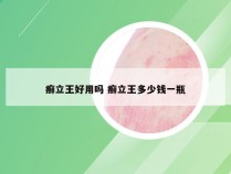 癣立王好用吗 癣立王多少钱一瓶