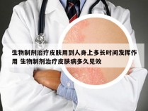 生物制剂治疗皮肤用到人身上多长时间发挥作用 生物制剂治疗皮肤病多久见效