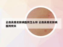 云南高原皮肤病医院怎么样 云南高原皮肤病医院院长