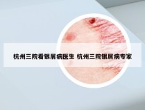 杭州三院看银屑病医生 杭州三院银屑病专家