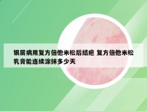 银屑病用复方倍他米松后结疤 复方倍他米松乳膏能连续涂抹多少天