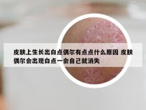 皮肤上生长出白点偶尔有点点什么原因 皮肤偶尔会出现白点一会自己就消失