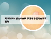 天津生物制剂治疗皮肤 天津哪个医院有生物制剂