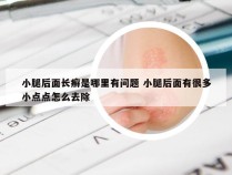 小腿后面长癣是哪里有问题 小腿后面有很多小点点怎么去除