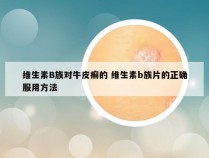 维生素B族对牛皮癣的 维生素b族片的正确服用方法