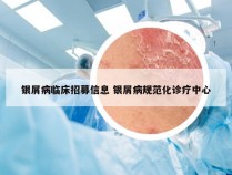 银屑病临床招募信息 银屑病规范化诊疗中心