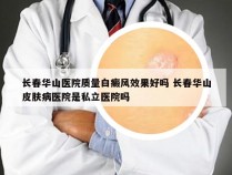 长春华山医院质量白癜风效果好吗 长春华山皮肤病医院是私立医院吗