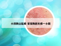 小孩胸口起癣 宝宝胸前长癣一小圈