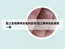 脸上出现两块白色的区域 脸上两块白色像斑一样