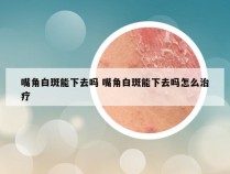 嘴角白斑能下去吗 嘴角白斑能下去吗怎么治疗