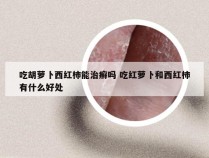 吃胡萝卜西红柿能治癣吗 吃红萝卜和西红柿有什么好处