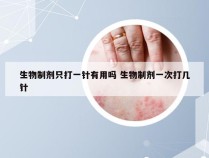 生物制剂只打一针有用吗 生物制剂一次打几针