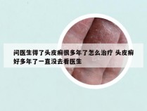 问医生得了头皮癣很多年了怎么治疗 头皮癣好多年了一直没去看医生