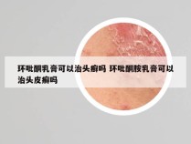 环吡酮乳膏可以治头癣吗 环吡酮胺乳膏可以治头皮癣吗