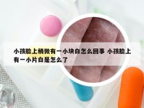 小孩脸上稍微有一小块白怎么回事 小孩脸上有一小片白是怎么了