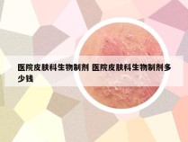 医院皮肤科生物制剂 医院皮肤科生物制剂多少钱