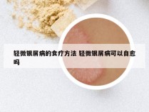 轻微银屑病的食疗方法 轻微银屑病可以自愈吗