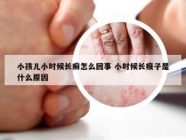 小孩儿小时候长癣怎么回事 小时候长瘊子是什么原因