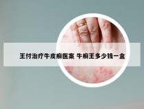 王付治疗牛皮癣医案 牛癣王多少钱一盒