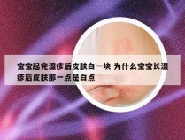 宝宝起完湿疹后皮肤白一块 为什么宝宝长湿疹后皮肤那一点是白点