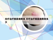 光疗治疗银屑病费用 光疗治疗银屑病费用多少