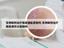 生物制剂治疗银屑病能报销吗 生物制剂治疗银屑病可以报销吗