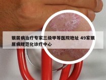 银屑病治疗专家三级甲等医院地址 49家银屑病规范化诊疗中心