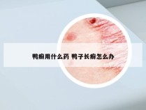 鸭癣用什么药 鸭子长癣怎么办