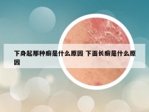 下身起那种癣是什么原因 下面长癣是什么原因