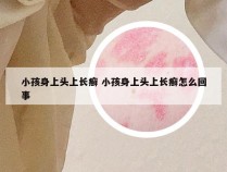 小孩身上头上长癣 小孩身上头上长癣怎么回事