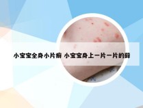 小宝宝全身小片癣 小宝宝身上一片一片的藓