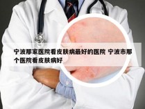 宁波那家医院看皮肤病最好的医院 宁波市那个医院看皮肤病好