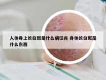 人体身上长白斑是什么病征兆 身体长白斑是什么东西