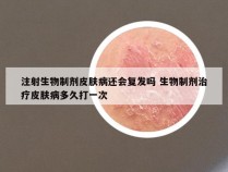 注射生物制剂皮肤病还会复发吗 生物制剂治疗皮肤病多久打一次