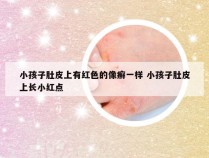 小孩子肚皮上有红色的像癣一样 小孩子肚皮上长小红点