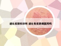 通化皮肤科诊所 通化有皮肤病医院吗