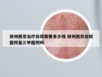 郑州西京治疗白斑需要多少钱 郑州西京白斑医院是三甲医院吗