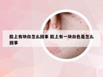 脸上有块白怎么回事 脸上有一块白色是怎么回事