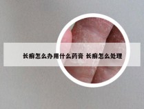 长癣怎么办用什么药膏 长癣怎么处理