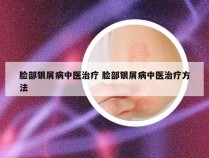 脸部银屑病中医治疗 脸部银屑病中医治疗方法