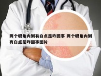 两个眼角内侧有白点是咋回事 两个眼角内侧有白点是咋回事图片