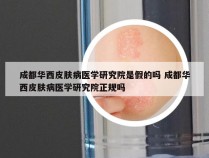 成都华西皮肤病医学研究院是假的吗 成都华西皮肤病医学研究院正规吗