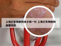 上海打生物制剂多少钱一针 上海打生物制剂需要住院