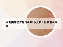 小儿面部起皮是什么癣 小儿脸上起皮怎么回事